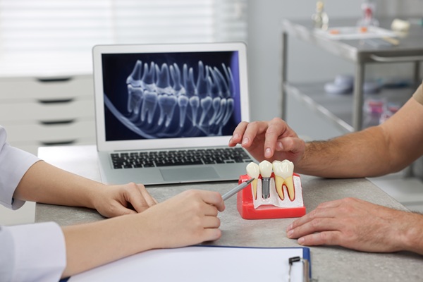 Why Do I Need A Crown After Root Canal Treatment?